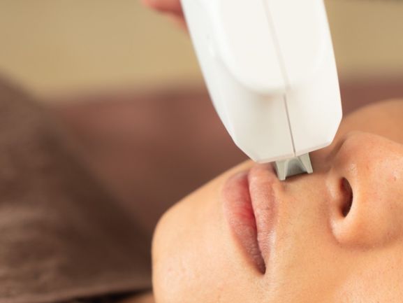 ヒゲ脱毛施術の様子 メンズ脱毛サロン米子エイト